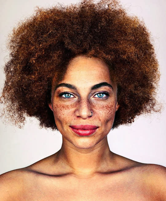 The artist wants to shoot freckled subjects from around the world