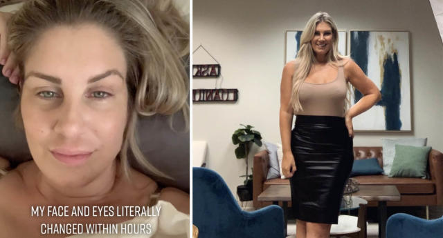 29-Year-Old Fitness Model Gets Breast Implants Removed after She Says the  Silicone Gave Her Seven Years of 'Brain Fog, Bald Spots and Rashes