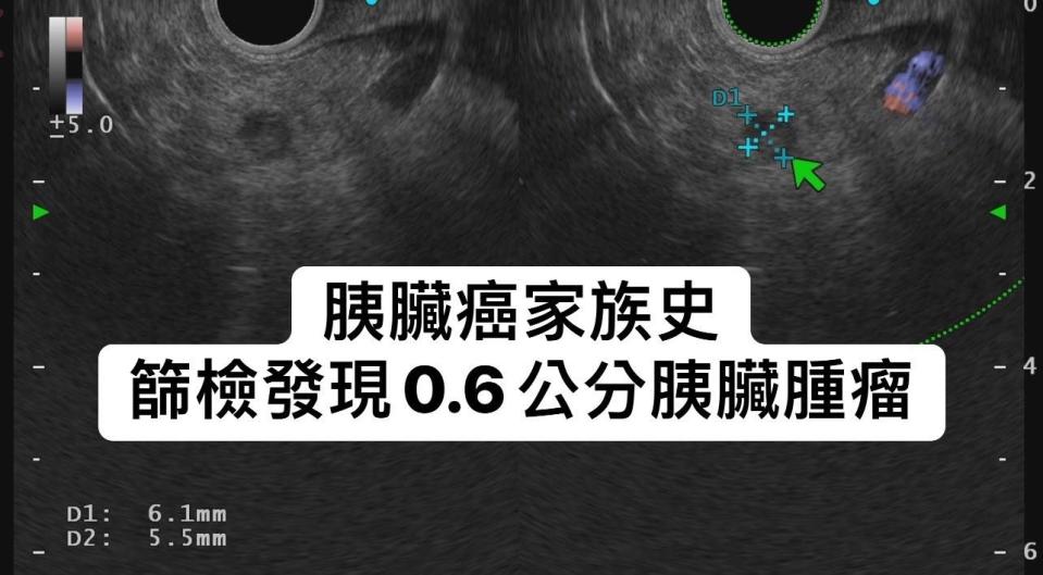 （圖／翻攝「胰臟醫師 林相宏 禾馨民權內科診所」臉書）