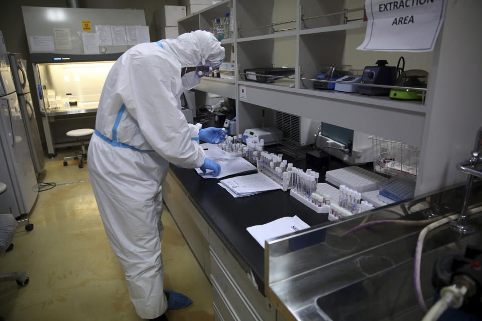 An Afghan lab technician tests samples at the Afghan-Japan Communicable Disease Hospital, treating COVID-19 patients in Kabul, Afghanistan, Tuesday June 30, 2020. (AP Photo/Rahmat Gul)