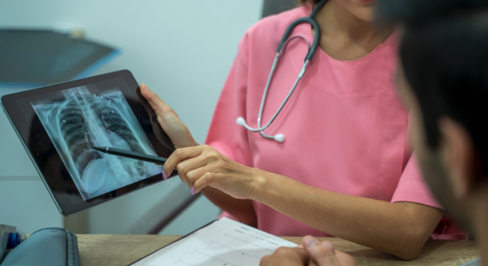 Tuberculosis is a serious bacterial disease that typically affects the lungs. The infectious disease is on the rise in Canada. (Photo via Getty Images)