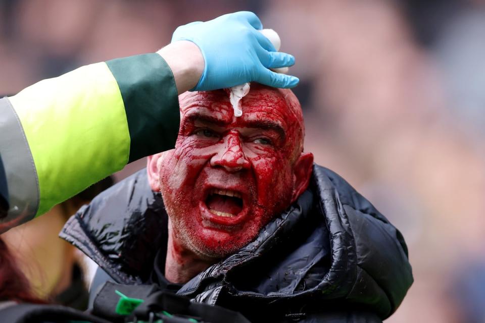 A number of fans were seen covered in blood after the clashes (Getty Images)