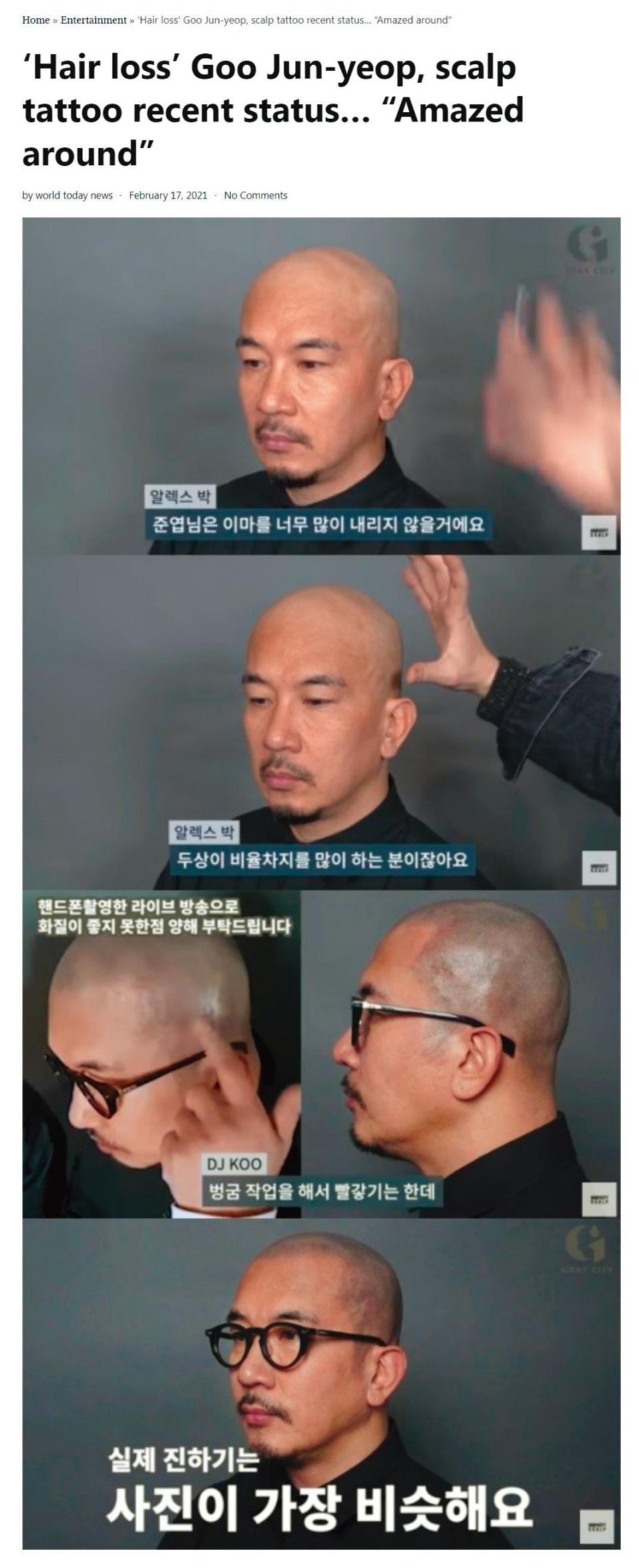 具俊曄曾經拍攝影片，分享自己做頭皮紋身的過程。（翻攝自World Today News）