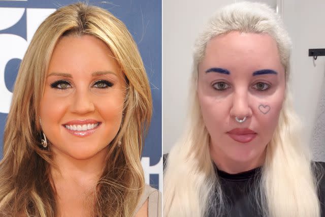 <p>Frank Trapper/Corbis via Getty; Amanda Bynes/ Instagram</p> Amanda Bynes before and after bleph surgery
