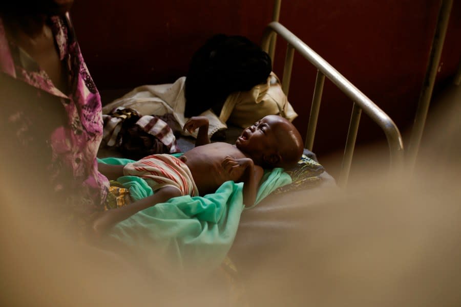 A severely malnourished child cries on his hospital bed at Bangui’s pediatric center in Bangui, Central African Republic, Tuesday Dec. 17, 2013. According to UNICEF’s doctor Celestin Traore, even though malnutrition is high in the country, the problem is worsening due to the conflict. Traore expects to see over 150 malnourished children daily in the coming days as the humanitarian situation worsens. Over 1600 French troops have been deployed to the country in an effort to put an end to sectarian violence. (AP Photo/Jerome Delay)