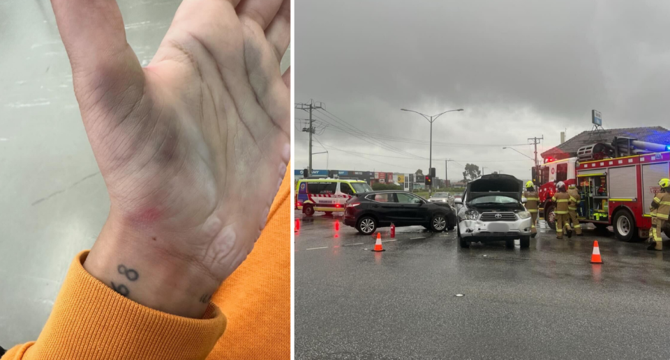 Izzy Singh shows where her hand was broken. Right:The crash scene showing the collision between a black and silver car.. Source: Supplied