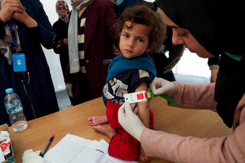 Palestinian children are checked for malnutrition, in Rafah, in the southern Gaza Strip