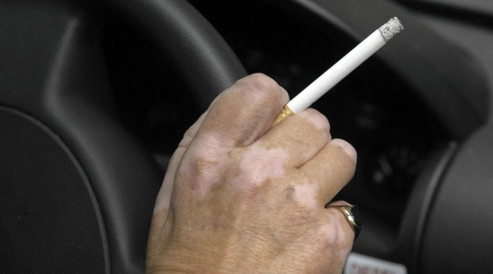 People can report drivers and passengers who discard their cigarette butts by throwing them out the window. Source: AAP