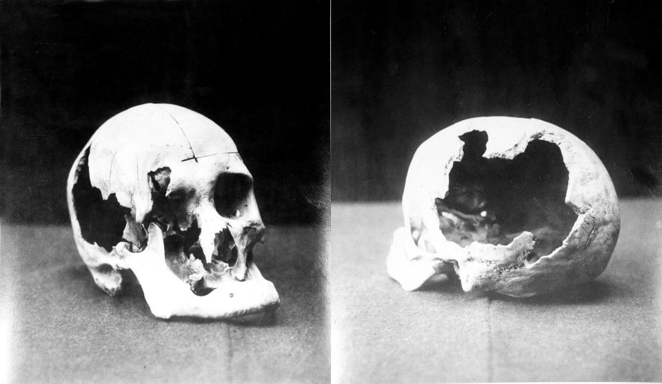 The skulls of Andrew, left, and Abigail Borden were smashed in with what is believed to have been a hatchet.