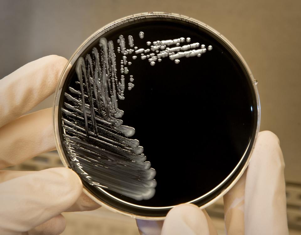 Legionella pneumophila, a bacterium that can cause Legionnaires’ disease, growing on specialized microbiological media.