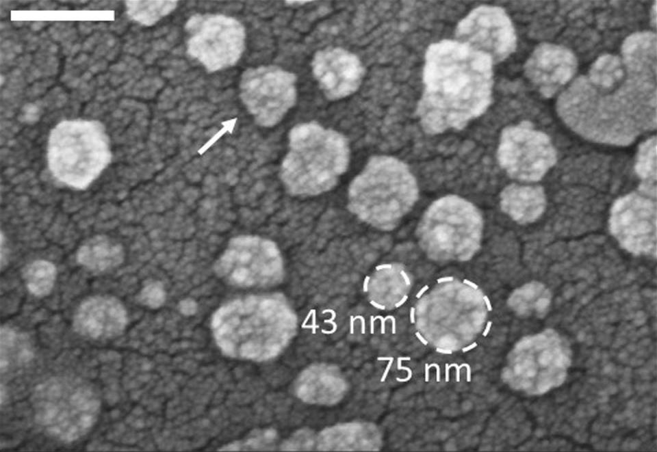 Exosomes (marked by the white arrow) can carry a variety of molecules out of a cell. <a href="https://flic.kr/p/JVTKPN" rel="nofollow noopener" target="_blank" data-ylk="slk:IBM Research/Flickr;elm:context_link;itc:0;sec:content-canvas" class="link ">IBM Research/Flickr</a>, <a href="http://creativecommons.org/licenses/by-nd/4.0/" rel="nofollow noopener" target="_blank" data-ylk="slk:CC BY-ND;elm:context_link;itc:0;sec:content-canvas" class="link ">CC BY-ND</a>