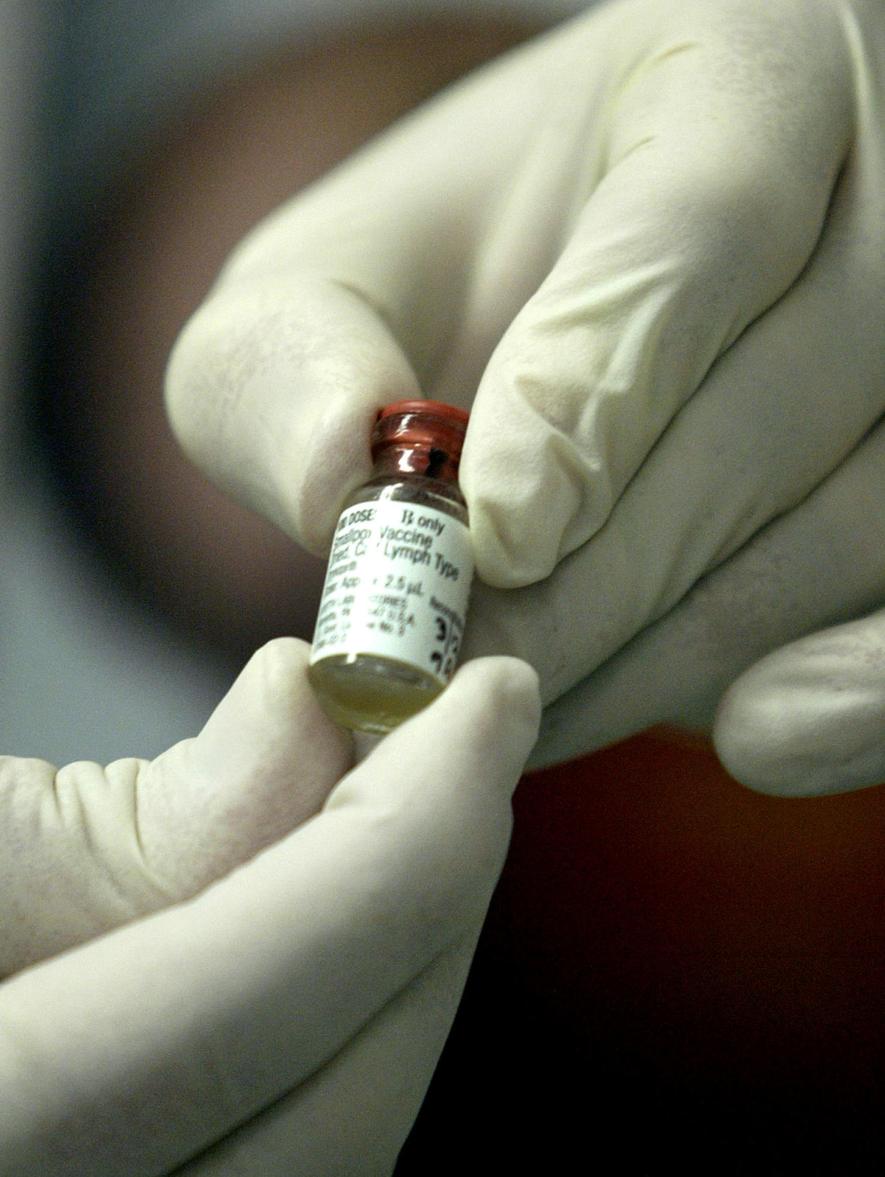 A bottle of smallpox vaccine held by gloved fingers.