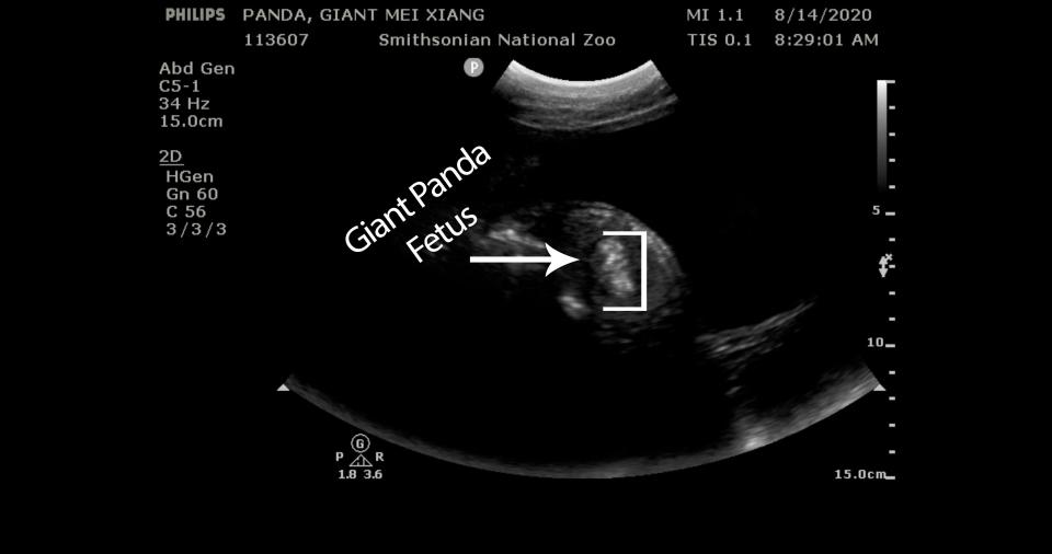 This Giant Panda ultrasound obtained August 17, 2020 courtesy of the Smithsonian's National Zoo shows what veterinarians at the Smithsonians National Zoo found in detected tissue consistent with fetal development during giant panda Mei Xiang's ultrasound on August 14, 2020.