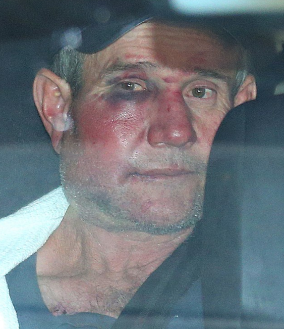 Gino Stocco after his final showdown with police. Photo: AAP