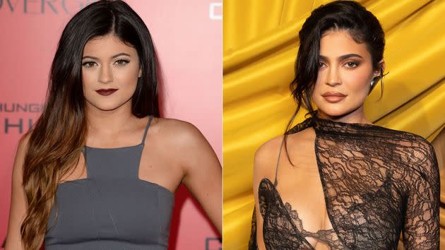 Kylie Jenner recently admitted that she regrets getting breast implants as a teen. 