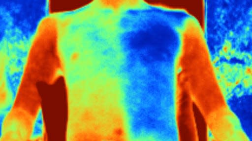 Infrared image of a person wearing super-cooling metafabric on their left side, which is much cooler than their right side, which is wearing cotton.