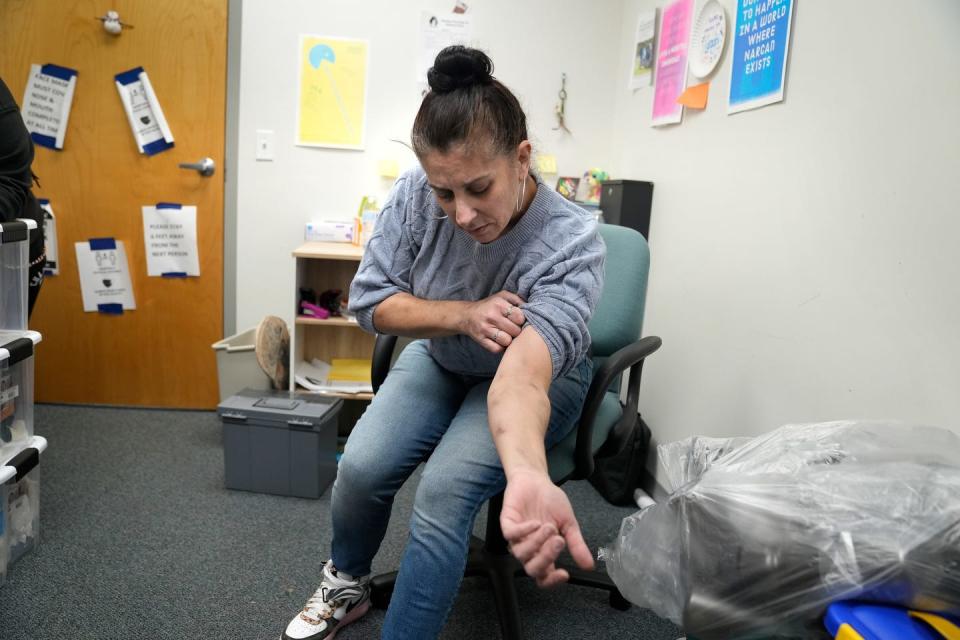 Amy Treglia shows scarring on her arms caused by xylazine, a veterinary tranquilizer that is being used as a cutting agent for heroin and fentanyl.