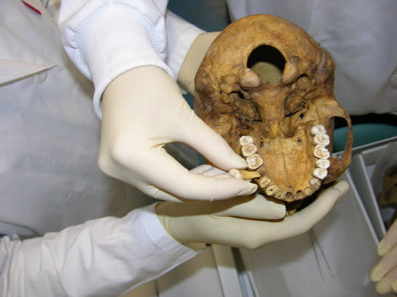 Teeth from an Egyptian mummy skull trace a record of ancient Egypt's drought.