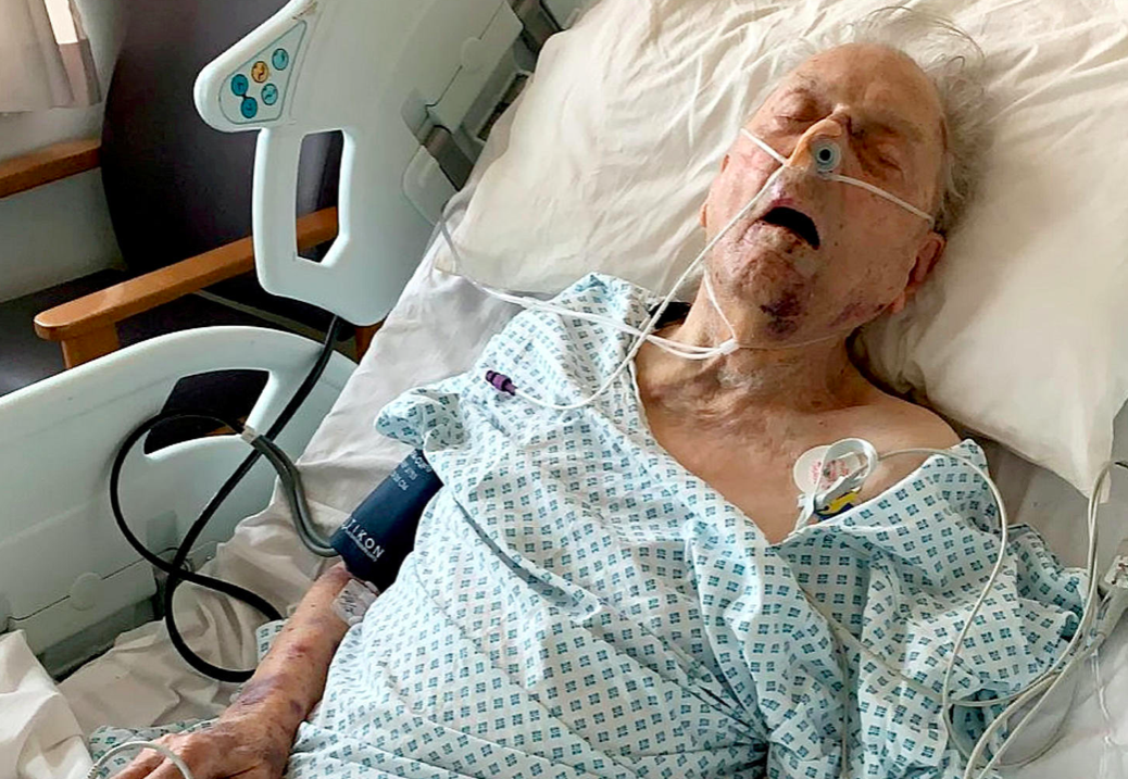 <em>Peter Gouldstone was left fighting for his life after attacked by burglars (SWNS)</em>