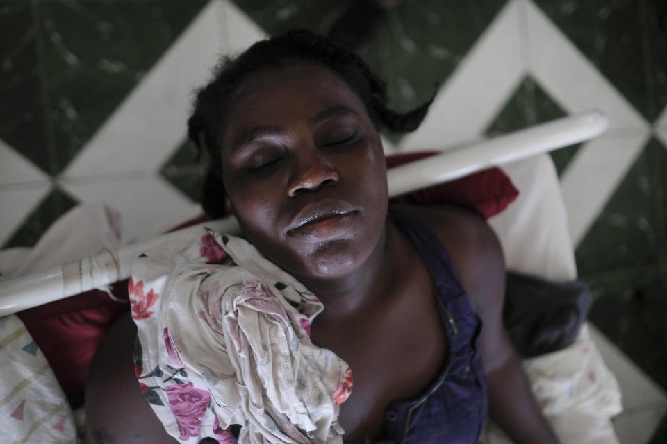 Jertha Ylet rests in a bed at the Immaculate Conception Hospital, also known as the General Hospital of Les Cayes in Les Cayes, Haiti, Monday, Aug. 23, 2021, a week after a 7.2 magnitude earthquake brought down her house in Camp-Perrin. The quake brought down their house in Camp-Perrin, killed her father and two other relatives and seriously injured her brother. (AP Photo/Matias Delacroix)