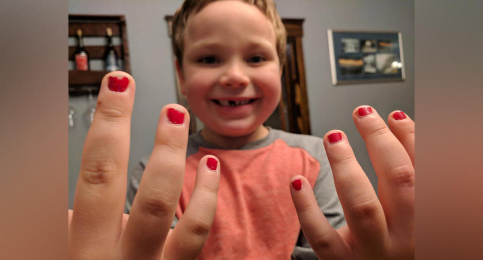 5-year-old Sam (pictured) shows off his nail polish, after experiencing school bullying 