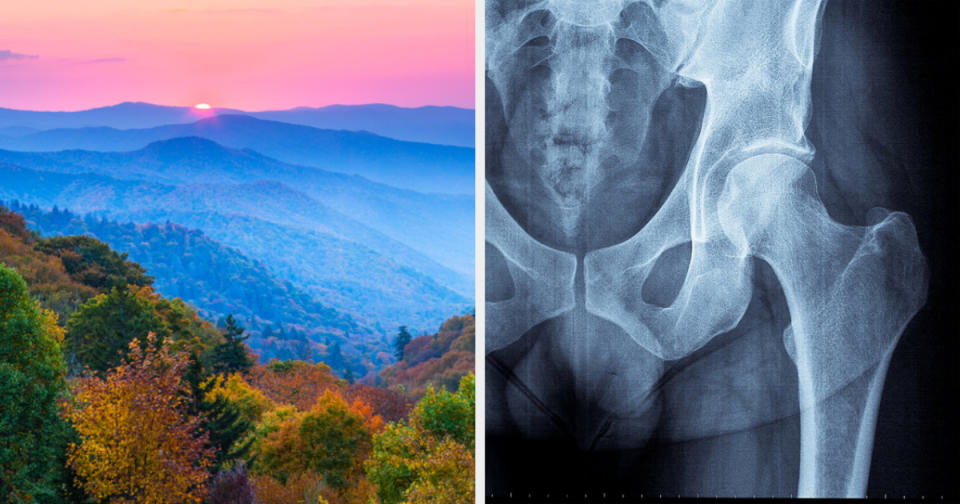 mountains and an x-ray