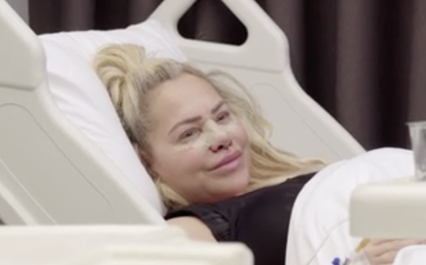 A woman laying in a hospital bed with bandages on her nose