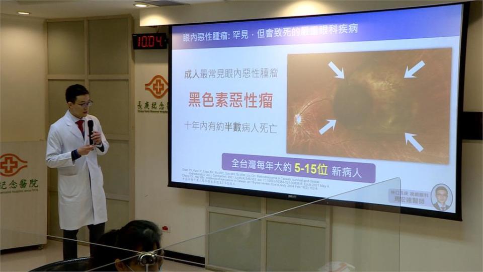 看東西出現「線條扭曲」　黑色素斑轉型成為惡性腫瘤