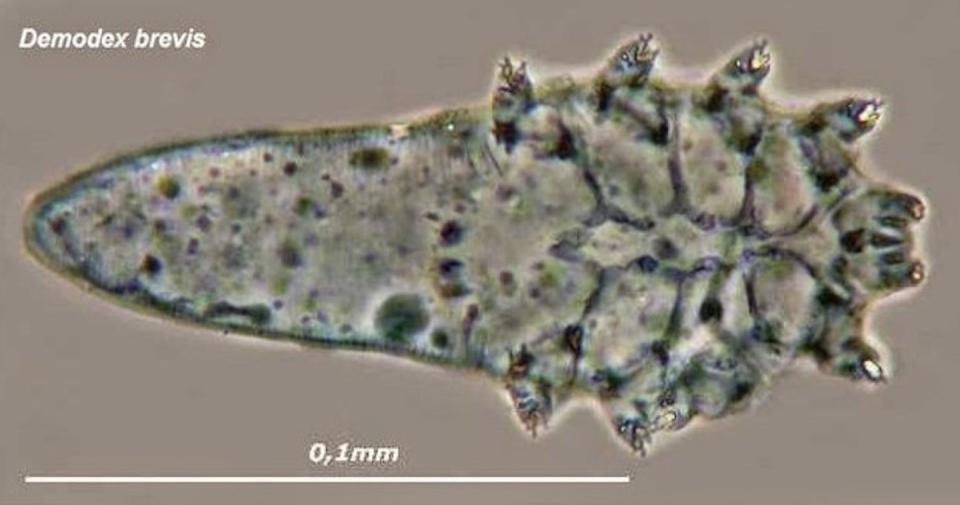 A close-up of Demodex brevis clearly shows the mouthparts they use to eat oils and skin cells off our faces. <a href="https://commons.wikimedia.org/wiki/File:Demodex_Brevis.jpg" rel="nofollow noopener" target="_blank" data-ylk="slk:Austin Whittall/Wikimedia Commons;elm:context_link;itc:0;sec:content-canvas" class="link ">Austin Whittall/Wikimedia Commons</a>