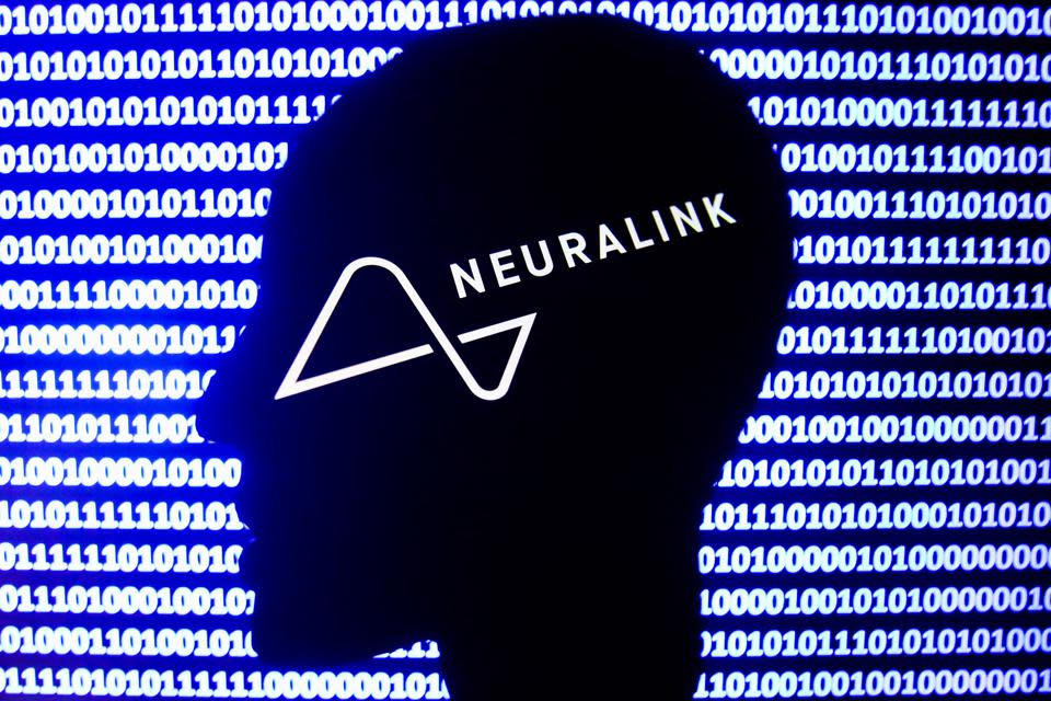 Neuralink Photo Illustrations