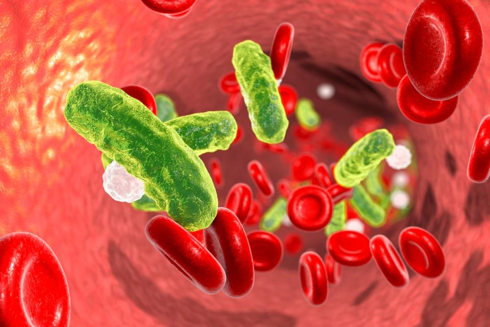 Sepsis, bacteria in blood. 3D illustration showing rod-shaped bacteria in blood with red blood cells and leukocytes (Getty Images/iStockphoto)