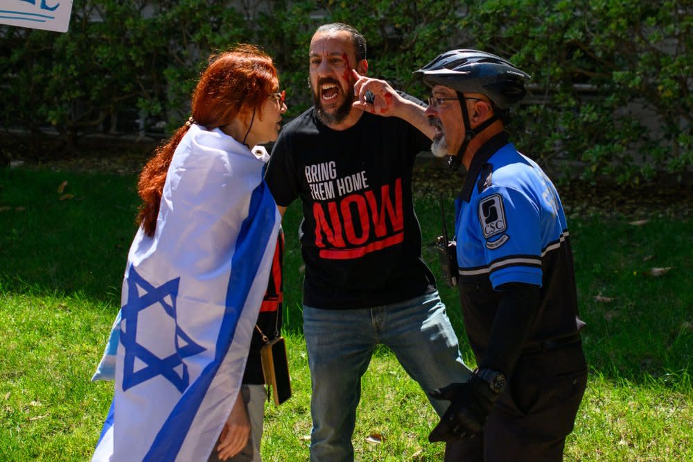 A counterprotester gestures to a bleeding injury on his eyebrow while talking to a Contemporary Services Corporation officer after an altercation on April 28.<span class="copyright">Brandon Morquecho for The Daily Bruin</span>