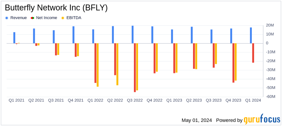 Butterfly Network Inc (BFLY) Surpasses Q1 Revenue Expectations and Raises 2024 Guidance