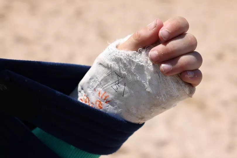 Prince William signs the cast of 9-year-old Phoenix Kanes. 
 The Duke of Cornwall, Prince William, visits Fistral Beach in Newquay on Thursday, May 9, meeting Holywell Bay and Newquay Surf Life Saving Clubs, as well as RNLI lifeguards.