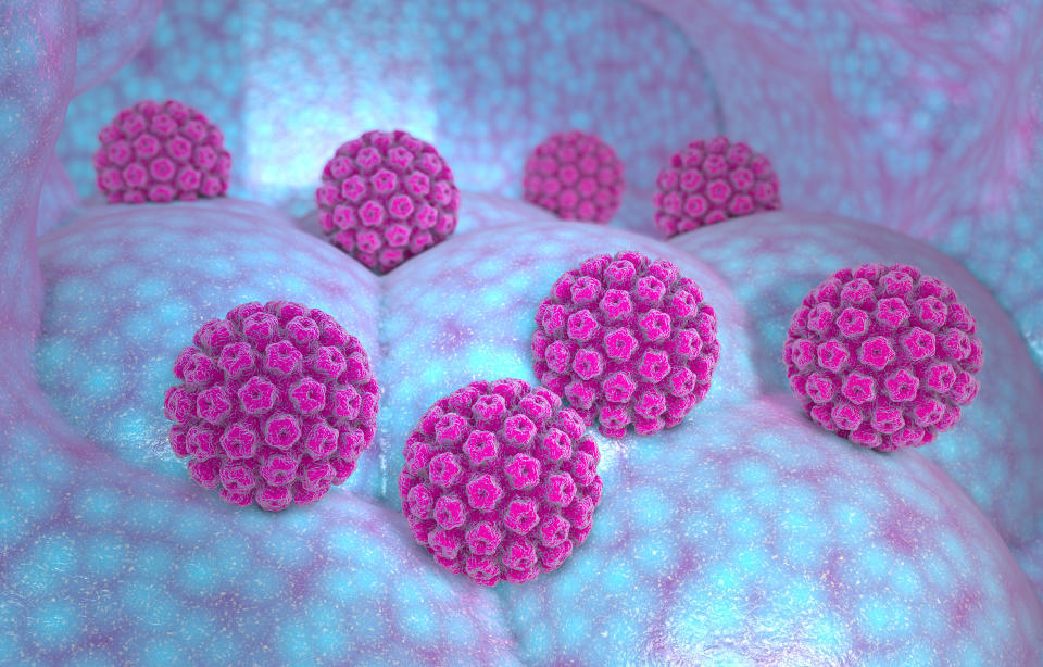 Human papillomavirus infection. Virus. HPV is the most common sexually transmitted infection globally. HPV infection is caused by human papillomavirus, a DNA virus from the papillomavirus family, 3d render