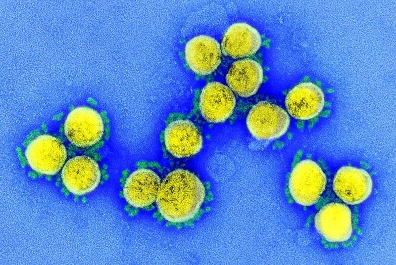 A colourized electron microscope image of SARS-CoV-2, the virus behind COVID-19. Scientists are now watching the Omicron subvariant XBB.1.5, which is on the rise in multiple countries, including the U.S. (U.S. National Institute of Allergy and Infectious Diseases - image credit)