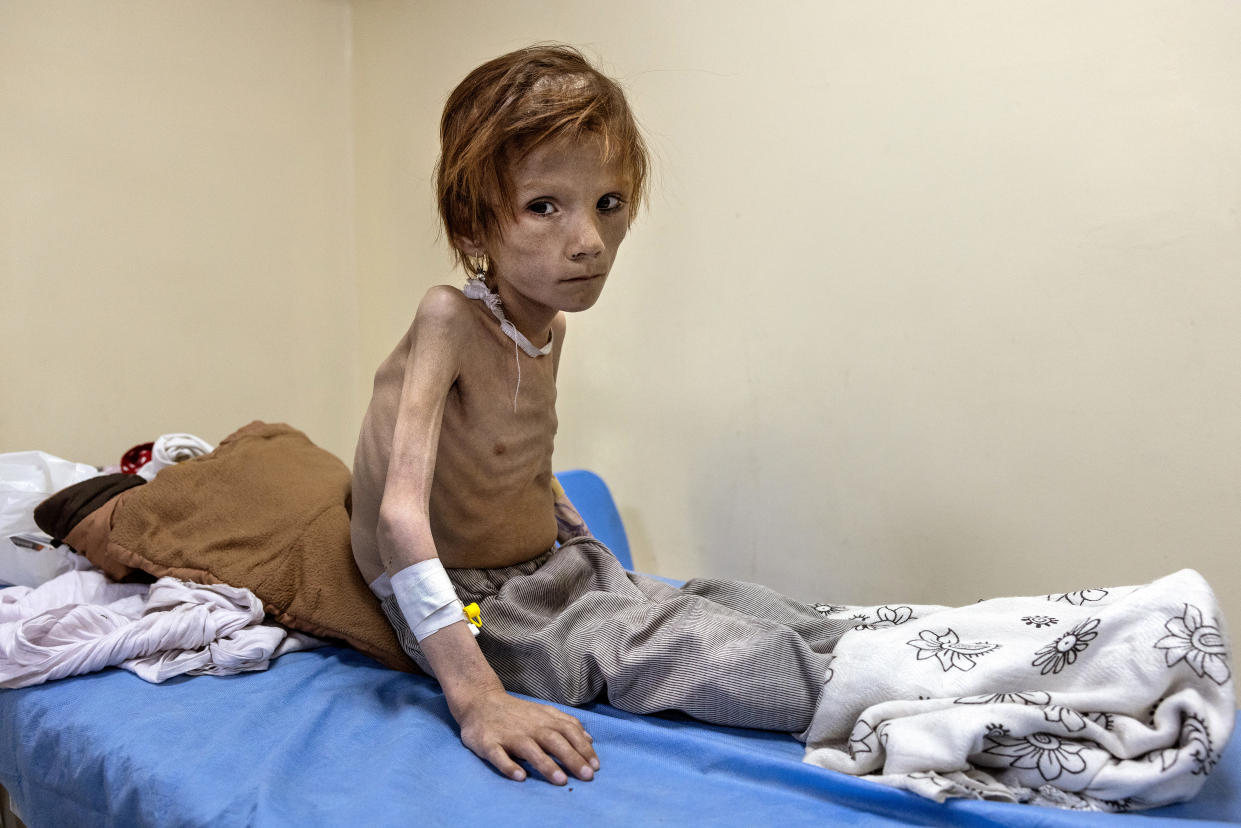 Eleven-year-old Rukia Jan sits in the emergency room at the Indira Ghandi Children's Hospital.