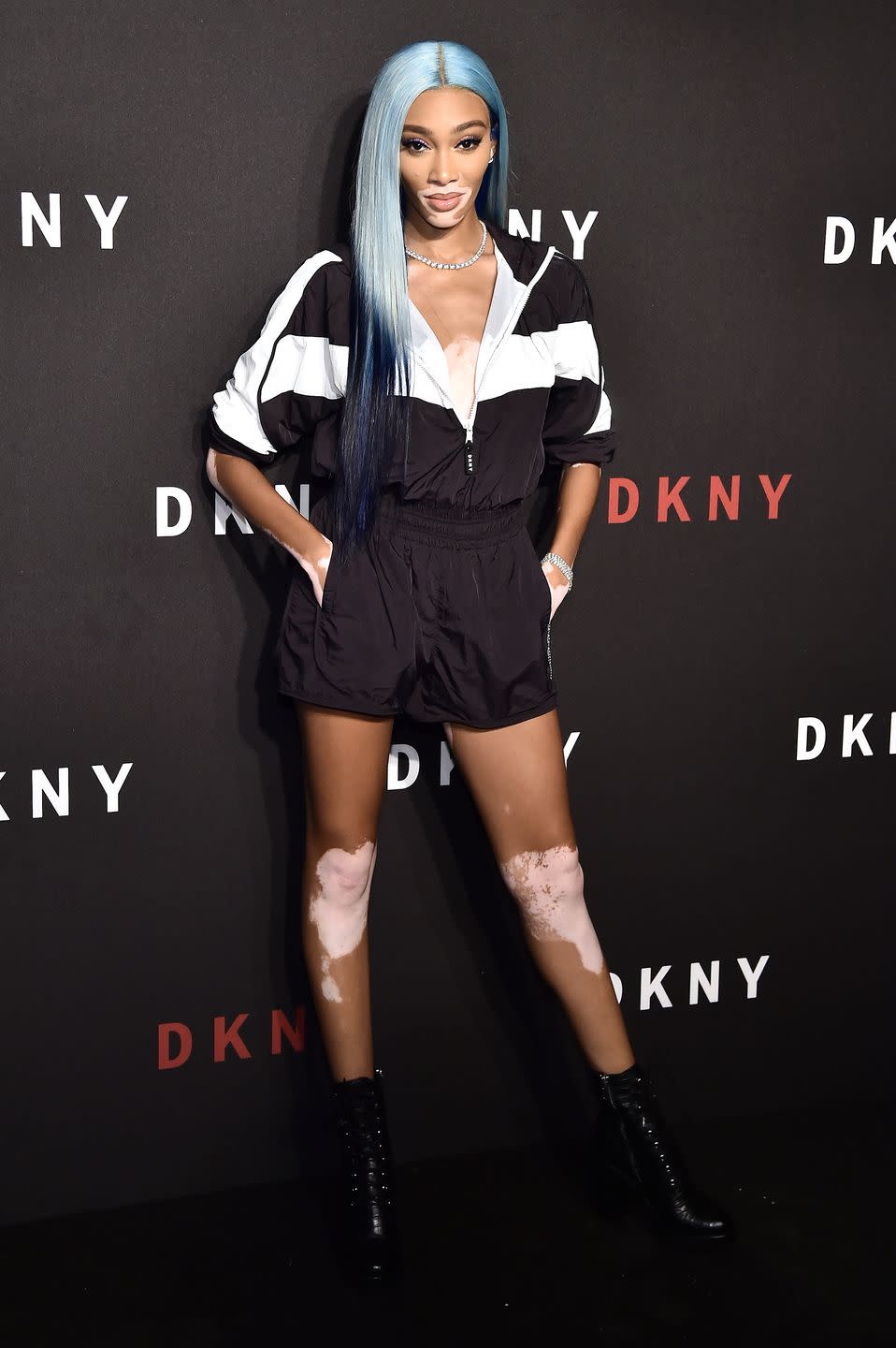 new york, new york   september 09 winnie harlow attends dkny 30th anniversary party at st anns warehouse on september 09, 2019 in new york city photo by steven ferdmangetty images