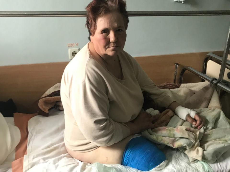 Antonina Budnik, a patient in a hospital in Chernihiv, who lost a leg and may lose her sight in one eye (Kim Sengupta)