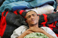 <p>A man injured during Saturday’s apparent Saudi-led air strike on a community hall lays on a hospital bed in the capital Sanaa, Yemen on Oct. 13, 2016. (Mohamed al-Sayaghi/Reuters)</p>