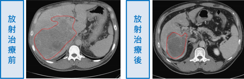 申先生治療照。（記者徐義雄翻攝）