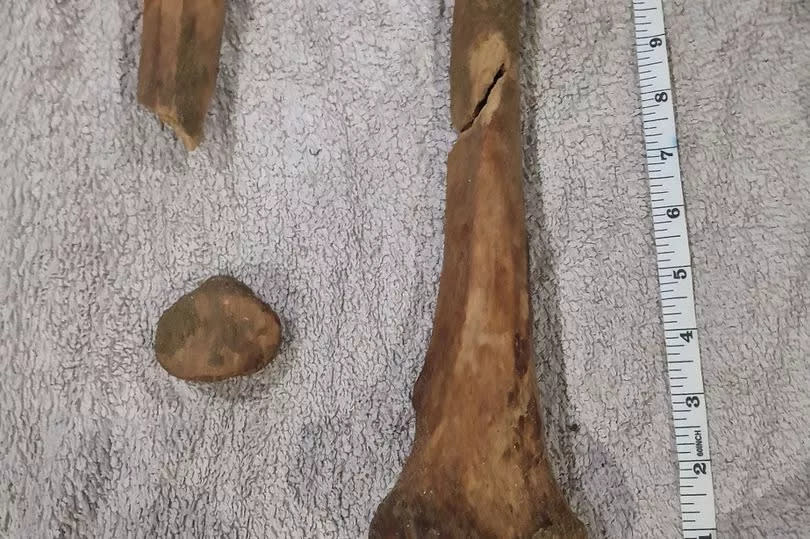 Police took the bones away for analysis and confirmed they were ancient human remains