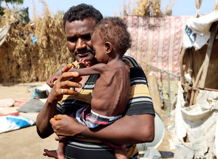 Hanaa Ahmad Ali Bahr, a malnourished girl is seen with her father at a shanty town in Hodeidah, Yemen March 25, 2019. REUTERS/Abduljabbar Zeyad