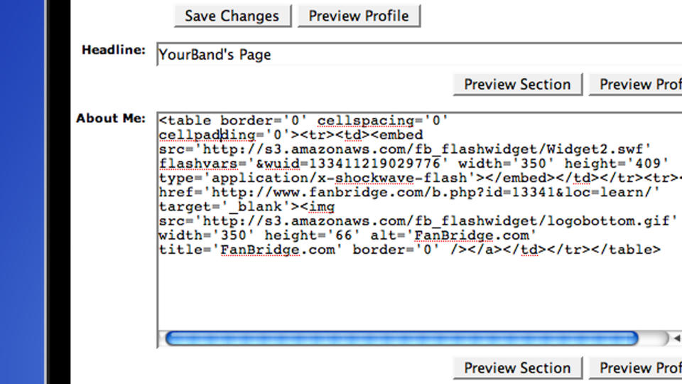 A laptop screen showing the HTML code for a MySpace profile page