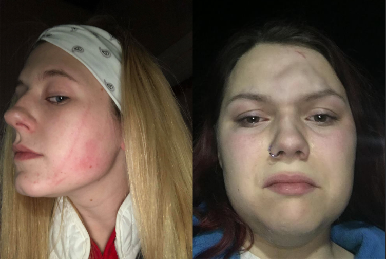 Teens Tatum Bohanon (L), Alexandra DeRusso (R), and Taylor McFadden (not pictured), were attacked by a group of adults in the parking lot of the Deptford Mall in New Jersey. (Photo: Courtesy of Taylor McFadden)