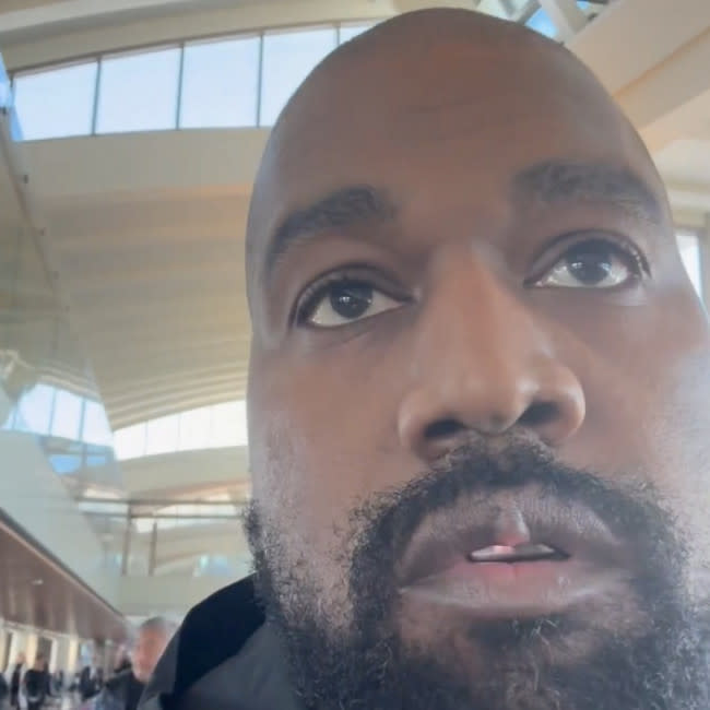 Kanye West en el vídeo que ha preocupado a sus fans por el bulto que tiene en el labio credit:Bang Showbiz