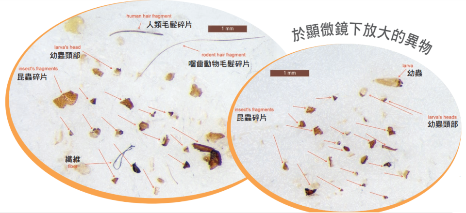 【家長留意】意粉藏毛髮毛髮異物　記低12款安全清單