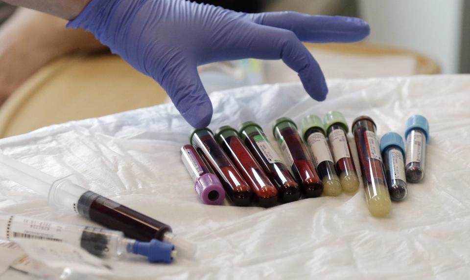 <span class="caption">A nurse reaches for blood samples from a patient at the Fred Hutchinson Cancer Center in Seattle that were to be used in CAR-T cell therapy March 21, 2017.</span> <span class="attribution"><a class="link " href="http://www.apimages.com/metadata/Index/Genetic-Frontiers-Living-Cancer-Drugs/2dde4a1d038640bcb09ef8ea415eaaac/3/0" rel="nofollow noopener" target="_blank" data-ylk="slk:AP Photo/Elaine Thompson;elm:context_link;itc:0;sec:content-canvas">AP Photo/Elaine Thompson</a></span>