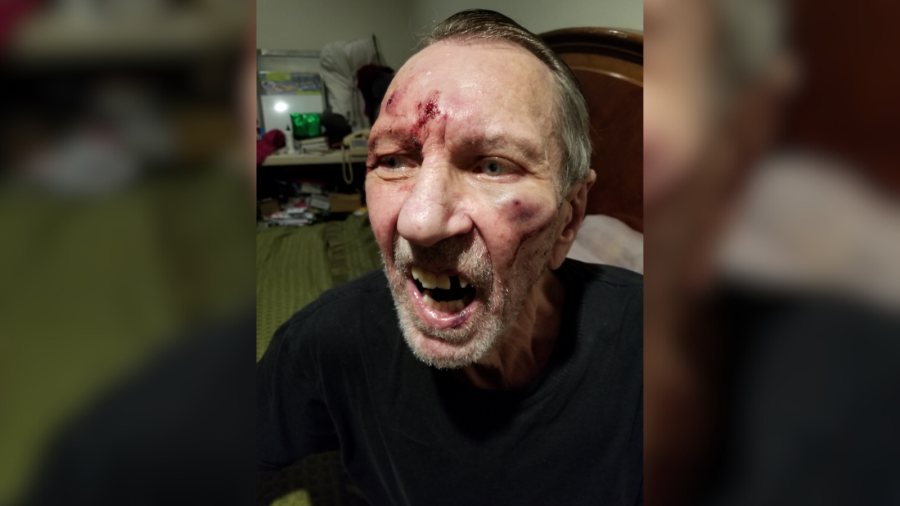 Uber driver Peter McNulty, 70, was brutally beaten by a passenger on April 21, 2024. (Peter McNulty)