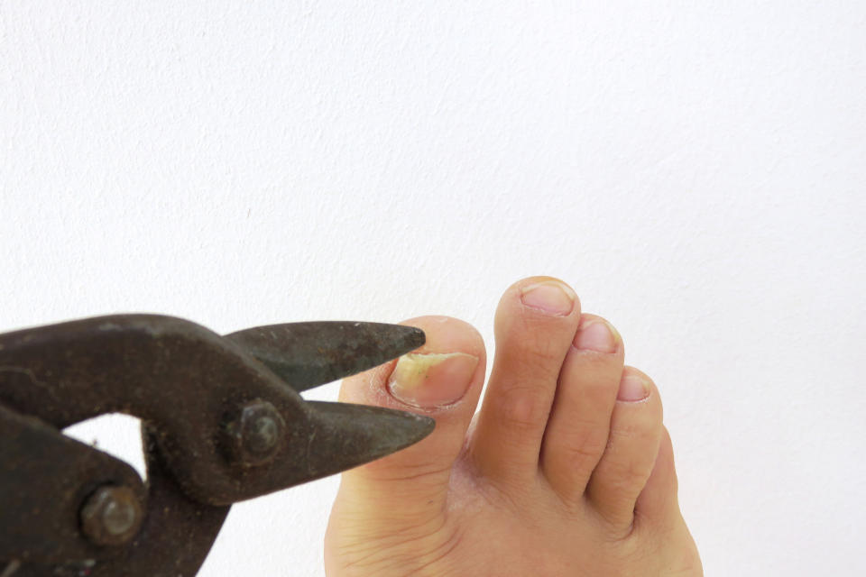 A person's foot with pliers positioned near a toenail, suggesting a nail trim